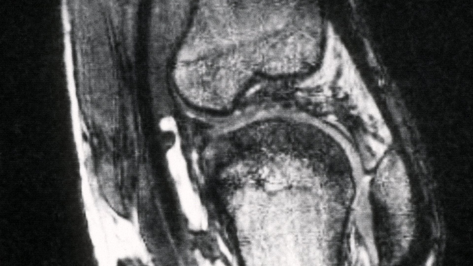 Schmerzen im Knie treiben viele Versicherte zum Orthopäden - viele kommen dort mit fragwürdigen Therapien in Kontakt. (Archivbild)