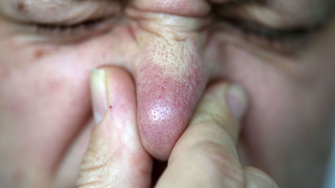 Ein Flug in der Economy-Klasse kann neben einem Viel-Pupser zur Herausforderung werden (Archivbild)