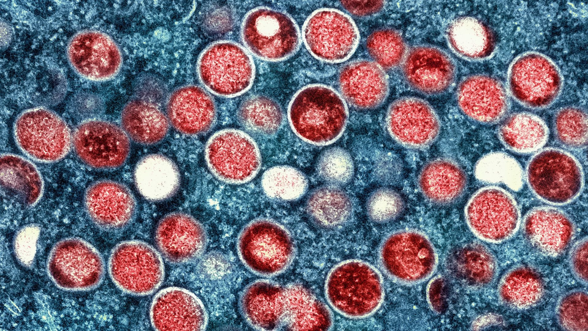 Überlässt die Welt die Zukunft von Mpox der Natur und dem Zufall? (Archivbild)