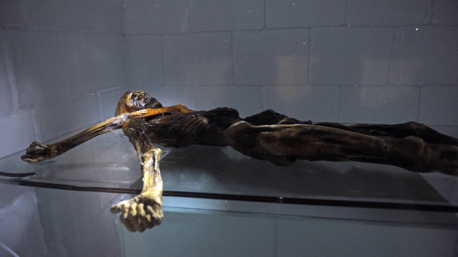 Schon der Gletschermann Ötzi war mit dem krebserregenden HPV16-Virus infiziert – und das vor 5.300 Jahren.