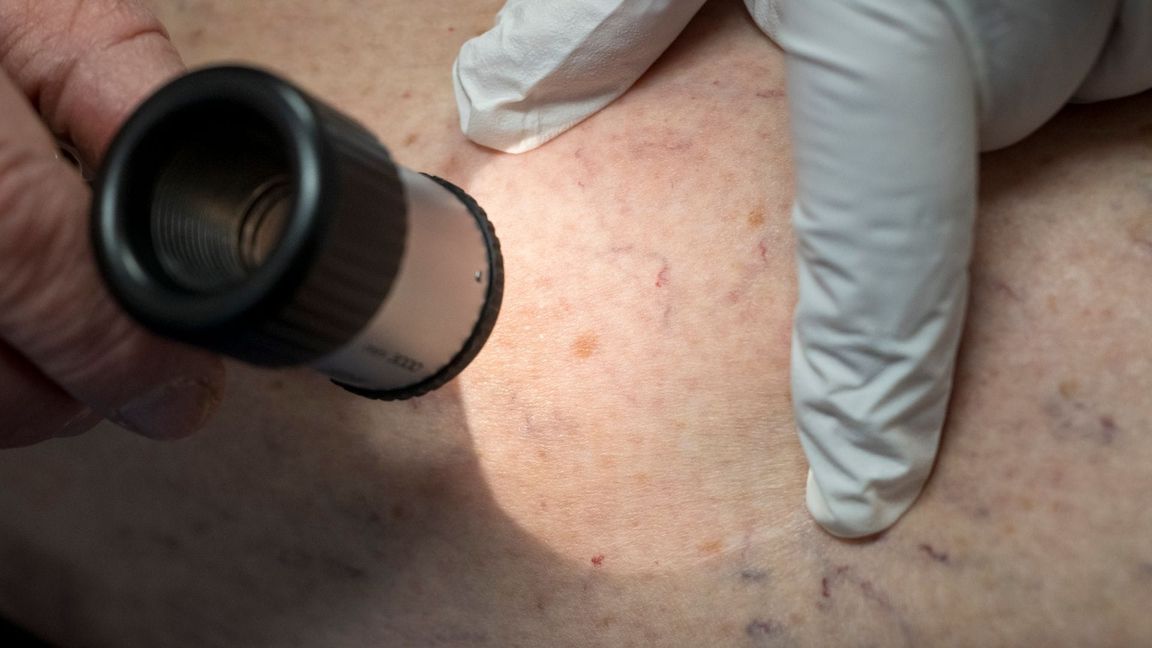 Ein Arzt untersucht in der Praxis die Hautpartie eines Patienten. (Archivbild)